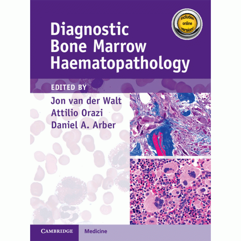 Diagnostic Bone Marrow Haematopathology