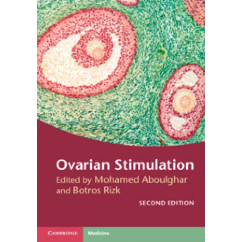 Ovarian Stimulation, 2E