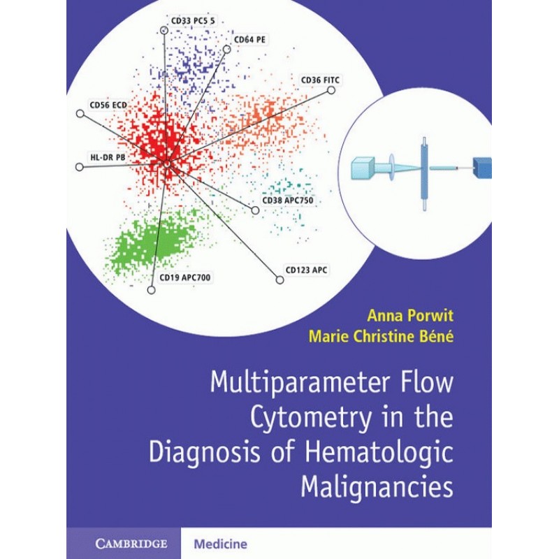 Multiparameter Flow Cytometry in the Diagnosis of Hematologic Malignancies