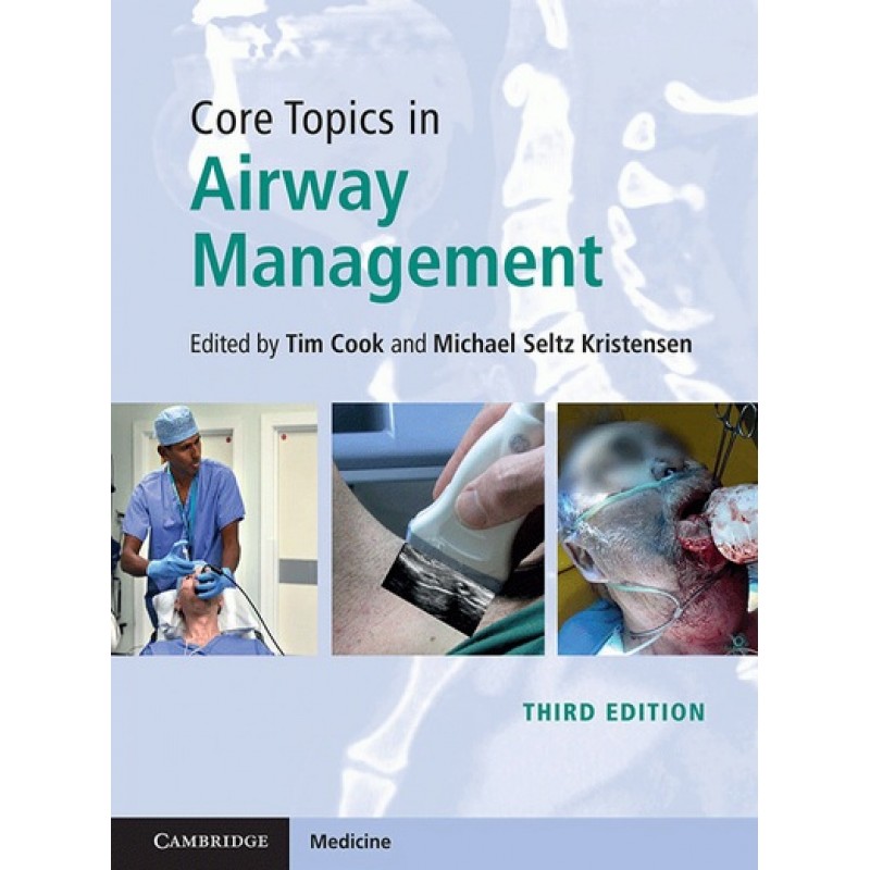 Core Topics in Airway Management 3E