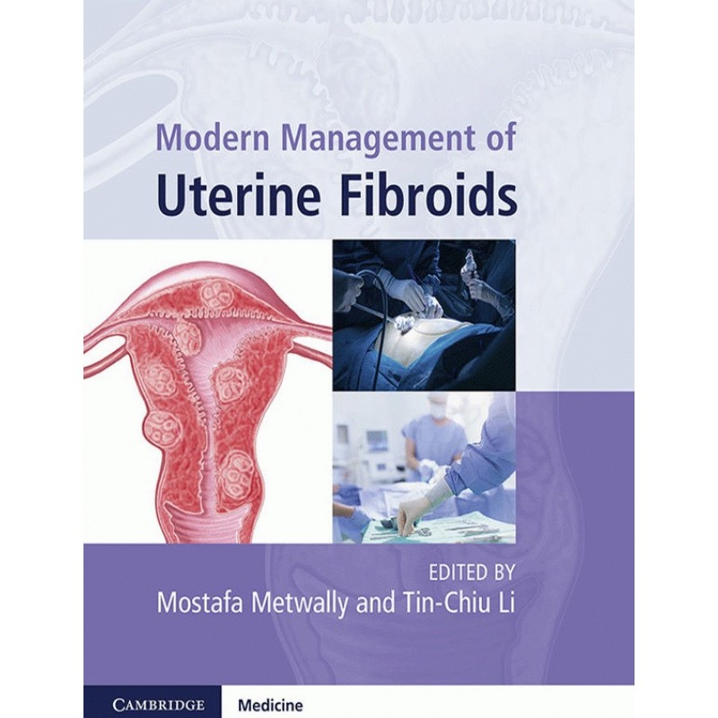 Modern Management of Uterine Fibroids