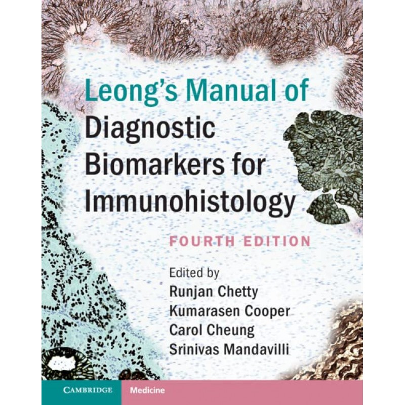 Leong’s Manual of Diagnostic Biomarkers for Immunohistology, 4E