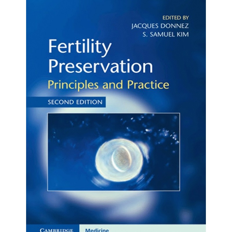 Fertility Preservation: Principles and Practice 2E