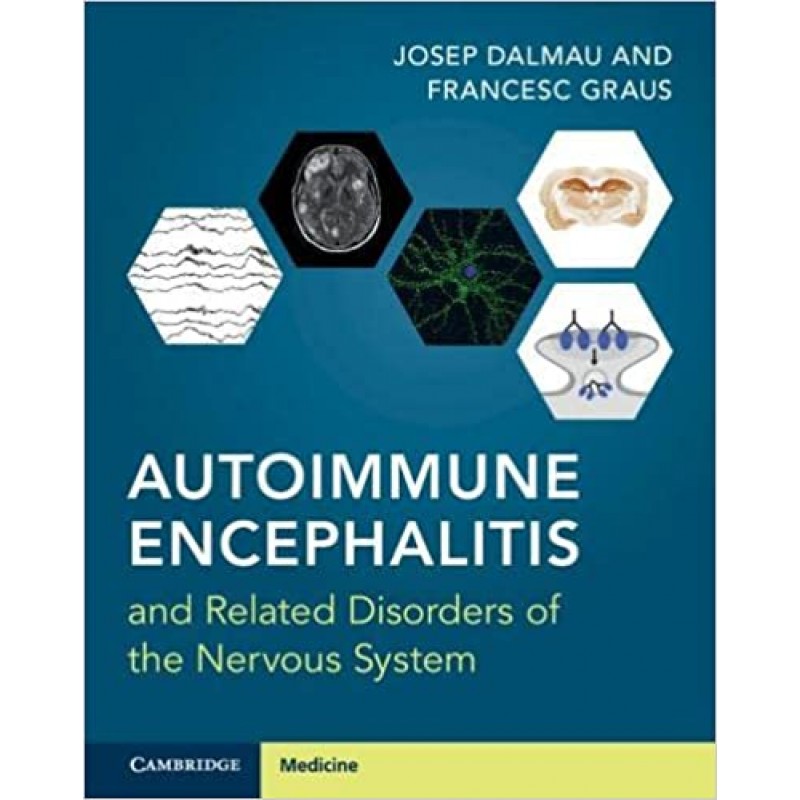 Autoimmune Encephalitis and Related Disorders of the Nervous System