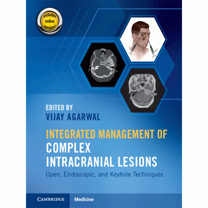 Integrated Management of Complex Intracranial Lesions: Open, Endoscopic, and Keyhole Techniques