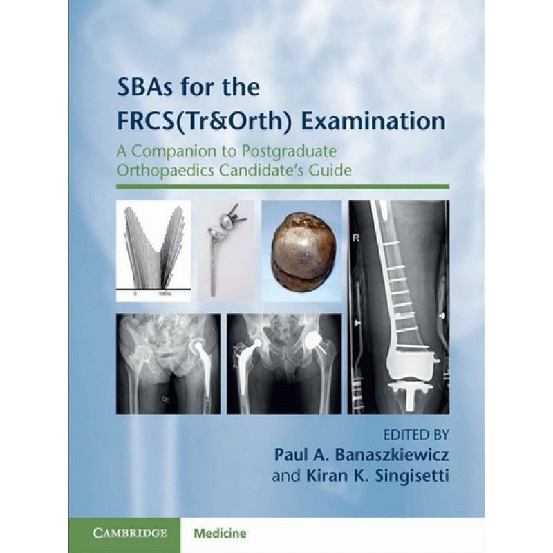 SBAs for the FRCS(Tr&Orth) Examination A Companion to Postgraduate Orthopaedics Candidate's Guide