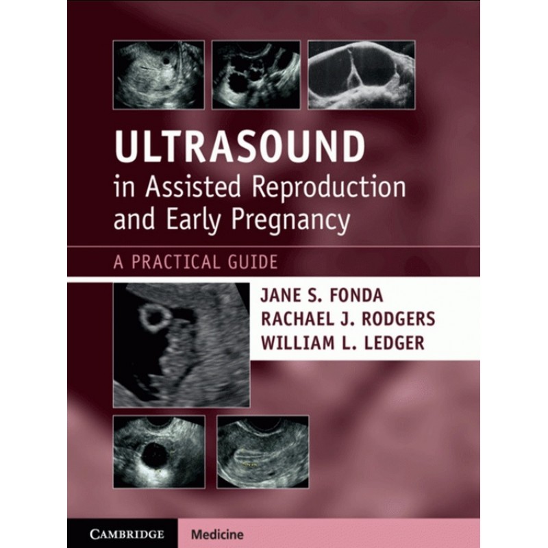 Ultrasound in Assisted Reproduction and Early Pregnancy: A Practical Guide