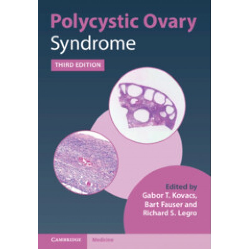 Polycystic Ovary Syndrome, 3E