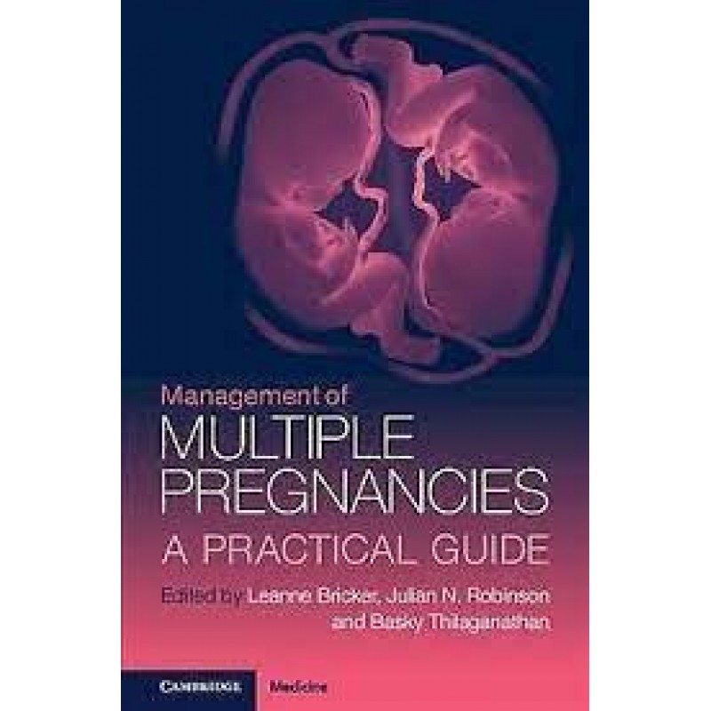 Management of Multiple Pregnancies A Practical Guide