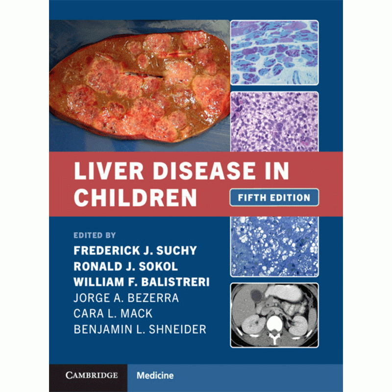 Liver Disease in Children, 5E