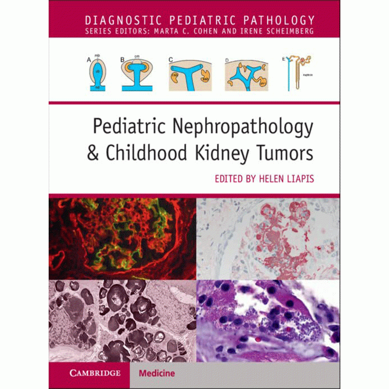 Pediatric Nephropathology & Childhood Kidney Tumors