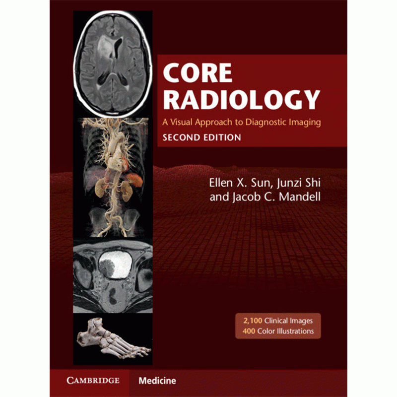 Core Radiology: A Visual Approach to Diagnostic Imaging (2-Volume Set), 2Ε