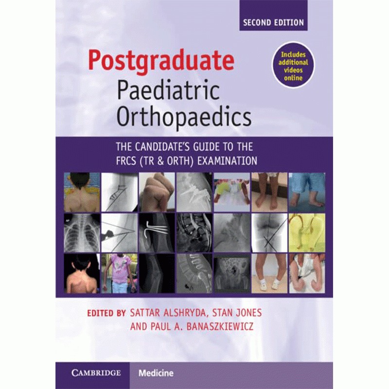 Postgraduate Paediatric Orthopaedics: The Candidate’s Guide to the FRCS(Tr&Orth) Examination, 2nd Edition