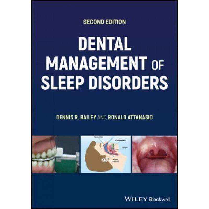 Dental Management of Sleep Disorders, 2E