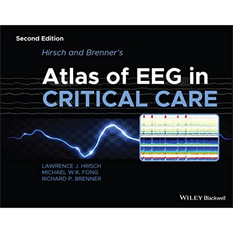 Hirsch and Brenner’s Atlas of EEG in Critical Care, 2nd Edition