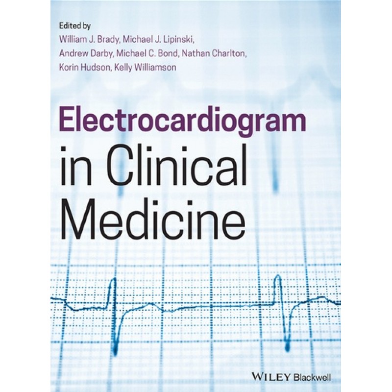 Electrocardiogram in Clinical Medicine