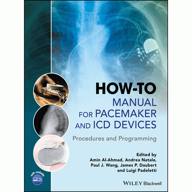 How-to Manual for Pacemaker and ICD Devices: Procedures and Programming