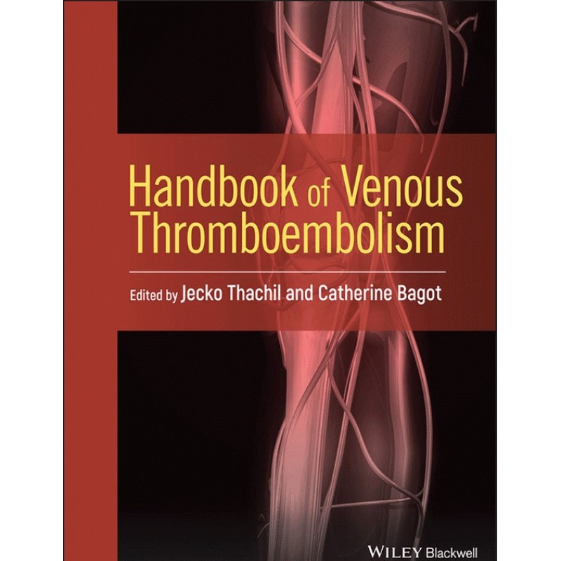 Handbook of Venous Thromboembolism