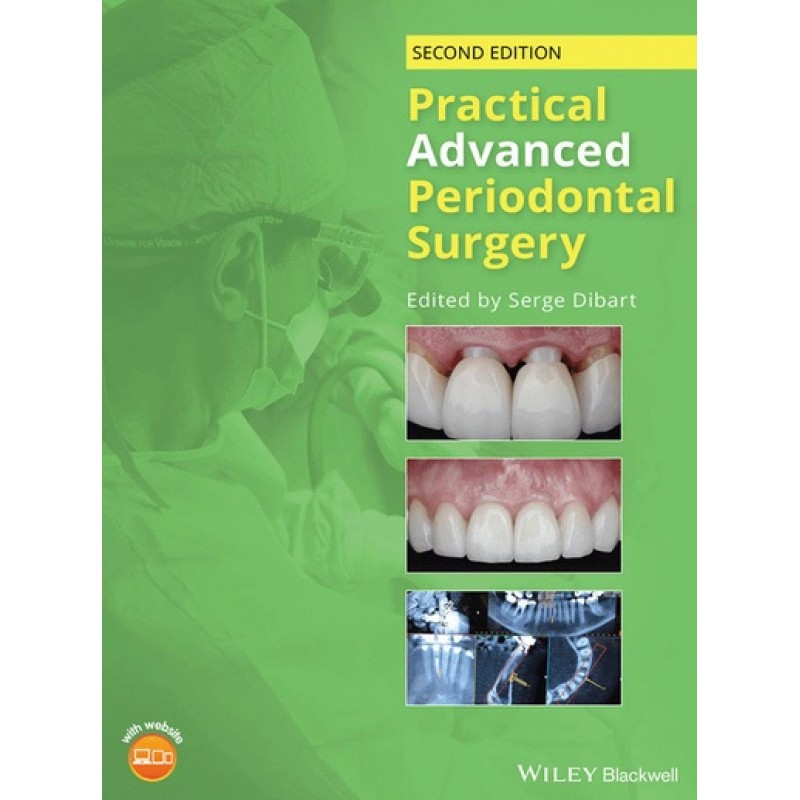 Practical Advanced Periodontal Surgery 2E