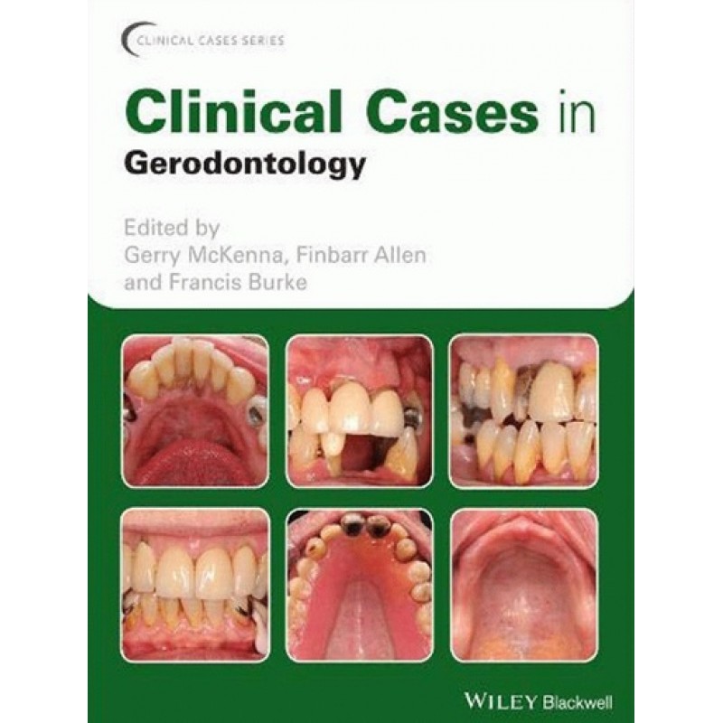 Clinical Cases in Gerodontology