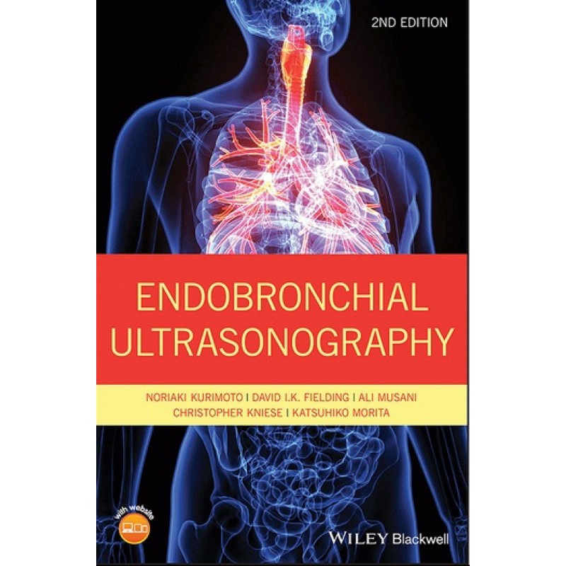 Endobronchial Ultrasonography 2E