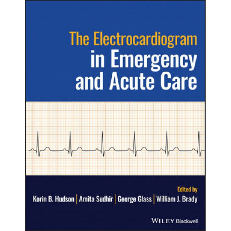 The Electrocardiogram in Emergency and Acute Care