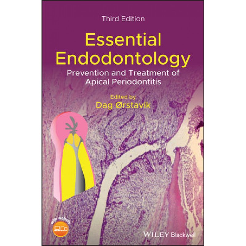 Essential Endodontology: Prevention and Treatment of Apical Periodontitis, 3rd Edition