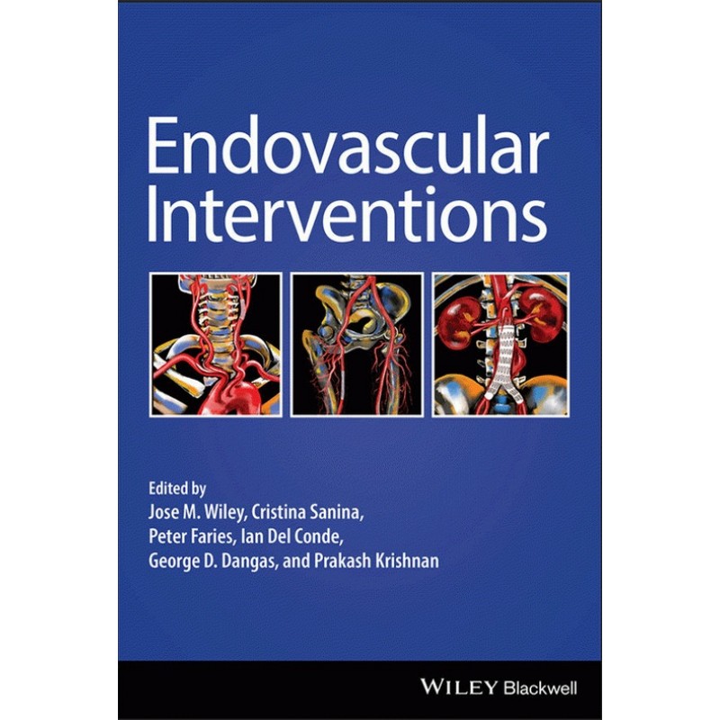 Endovascular Interventions