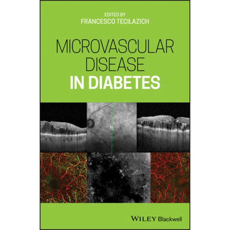 Microvascular Disease in Diabetes