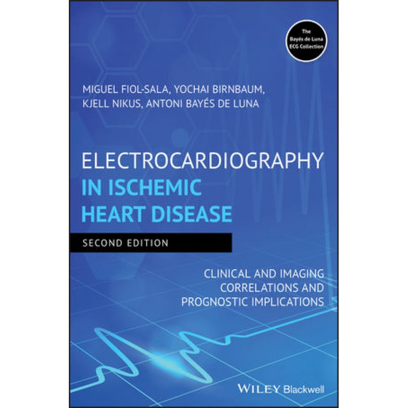 Electrocardiography in Ischemic Heart Disease: Clinical and Imaging Correlations and Prognostic Implications, 2nd Edition