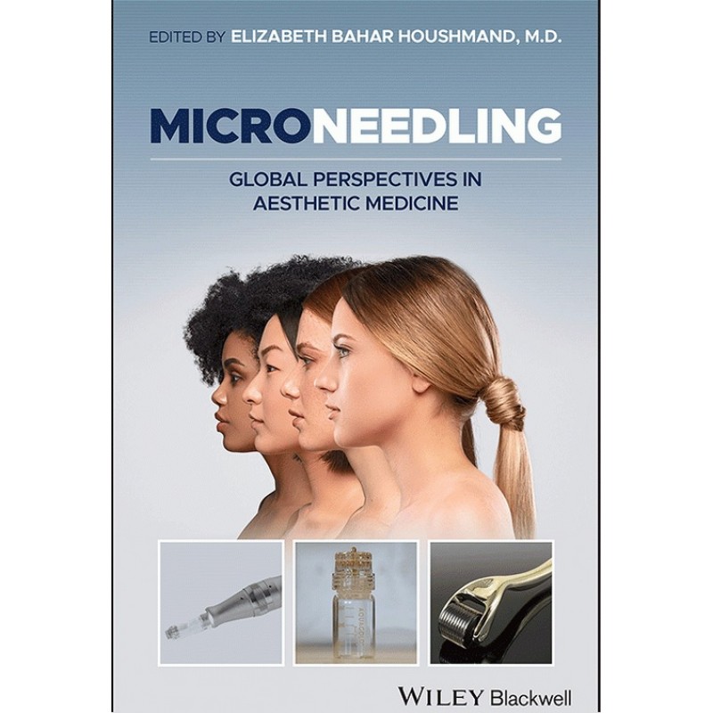 Microneedling: Global Perspectives in Aesthetic Medicine