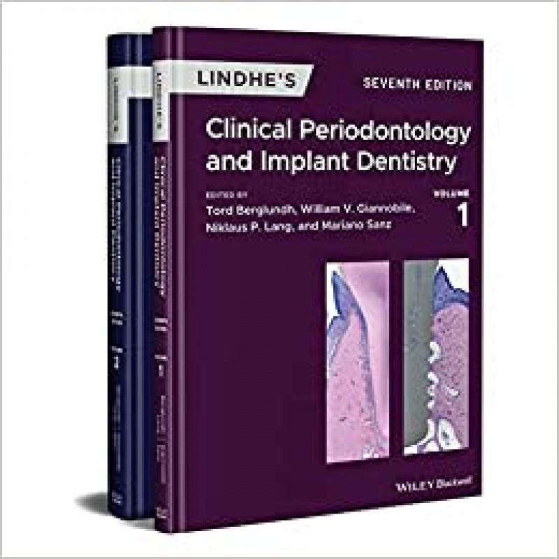 Lindhe's Clinical Periodontology and Implant Dentistry, 2 Volume Set, 7E