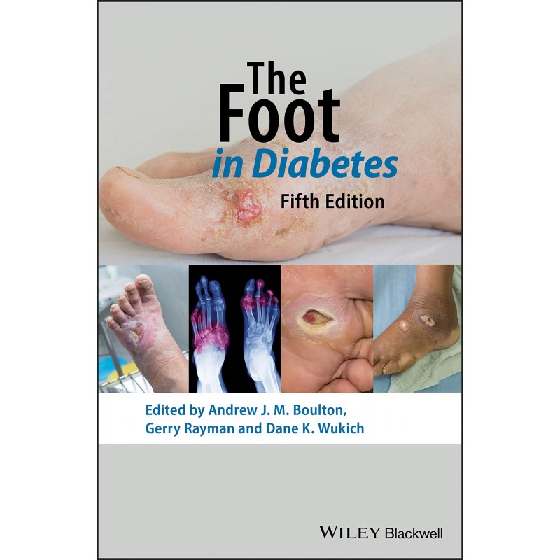 The Foot in Diabetes, 5th Edition