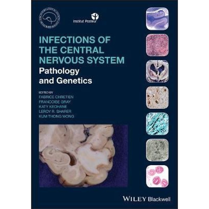 Infections of the Central Nervous System Pathology and Genetics