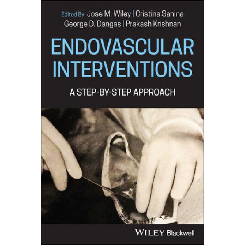 Endovascular Interventions: A Step-by-Step Approach