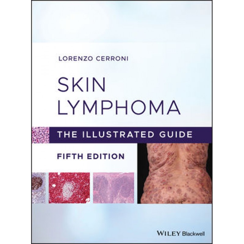 Skin Lymphoma: The Illustrated Guide, 5th Edition