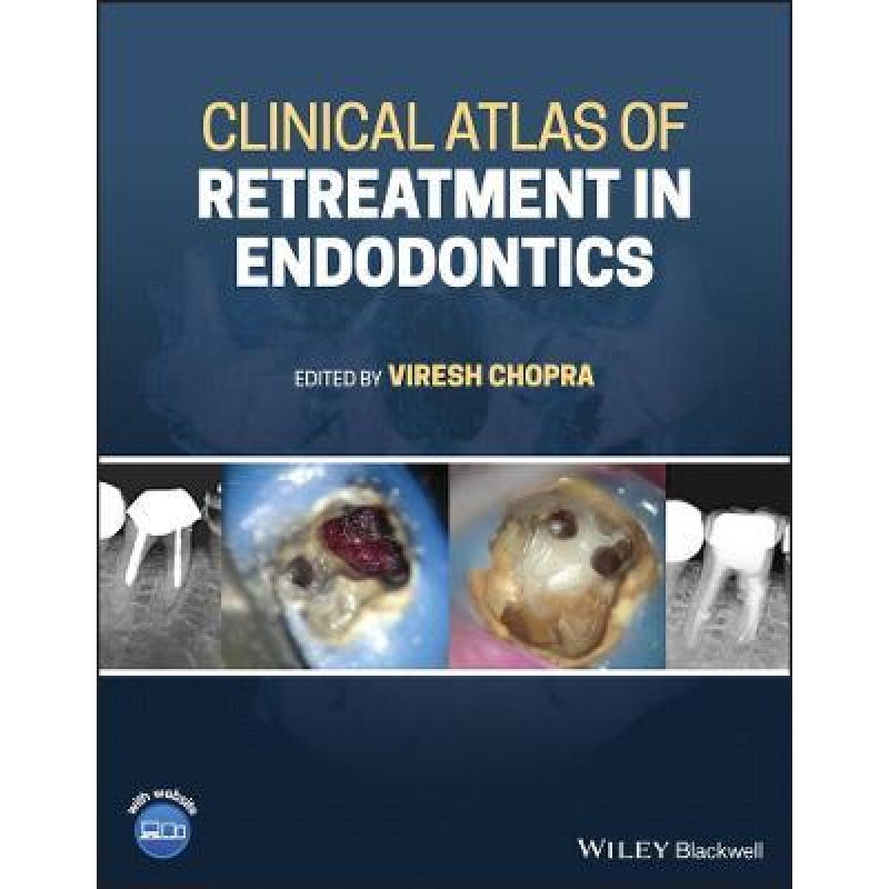 Clinical Atlas of Retreatment in Endodontics