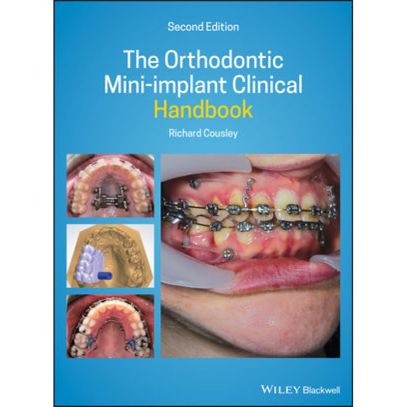 The Orthodontic Mini-implant Clinical Handbook, 2nd Edition