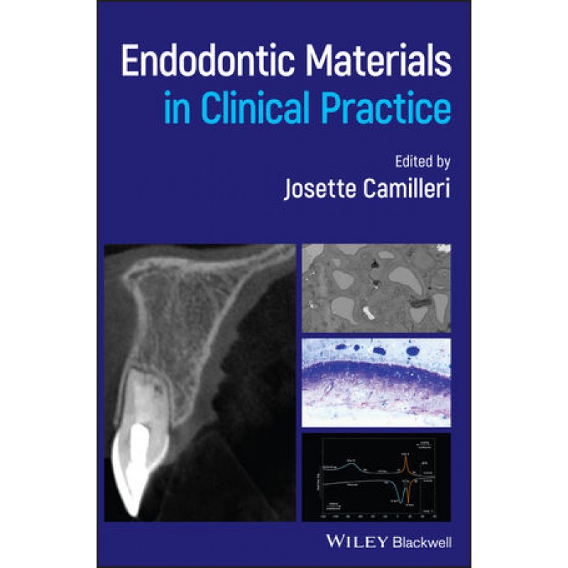 Endodontic Materials in Clinical Practice