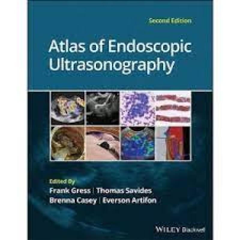 Atlas of Endoscopic Ultrasonography, 2Ε