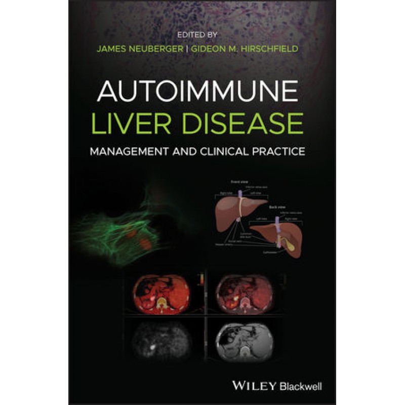 Autoimmune Liver Disease: Management and Clinical Practice