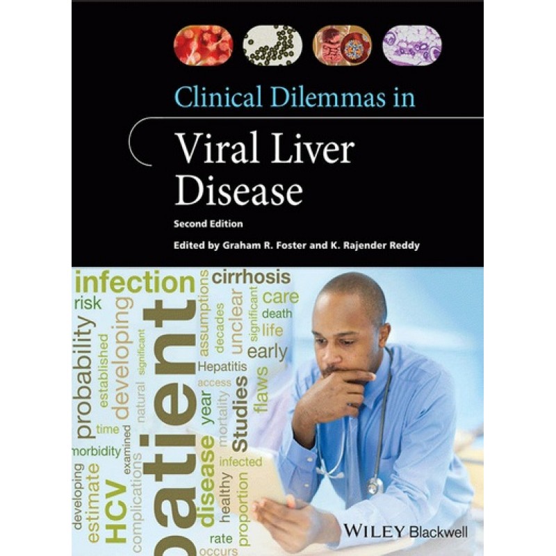 Clinical Dilemmas in Viral Liver Disease 2E