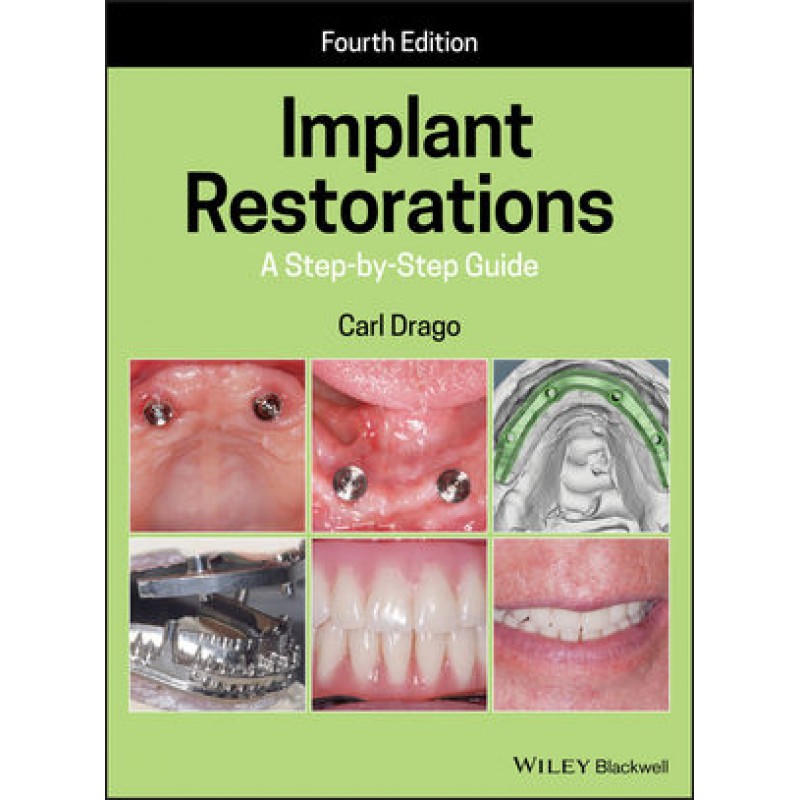 Implant Restorations: A Step-by-Step Guide, 4th Edition