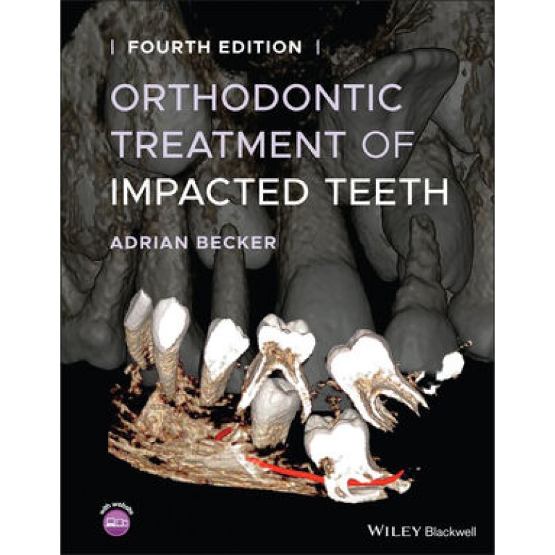 Orthodontic Treatment of Impacted Teeth, 4E