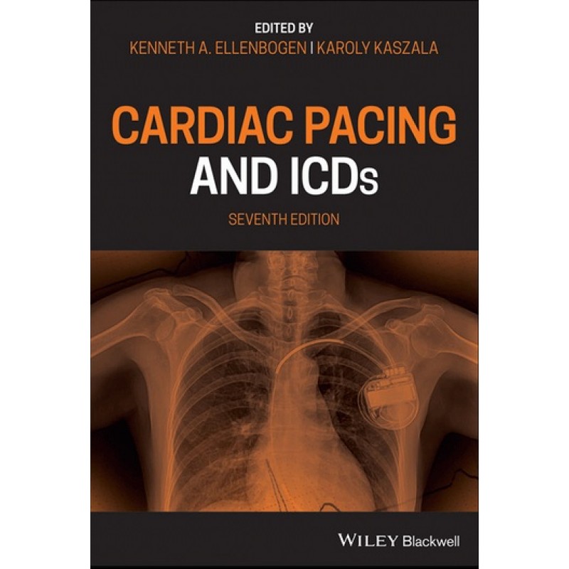 Cardiac Pacing and ICDs 7E