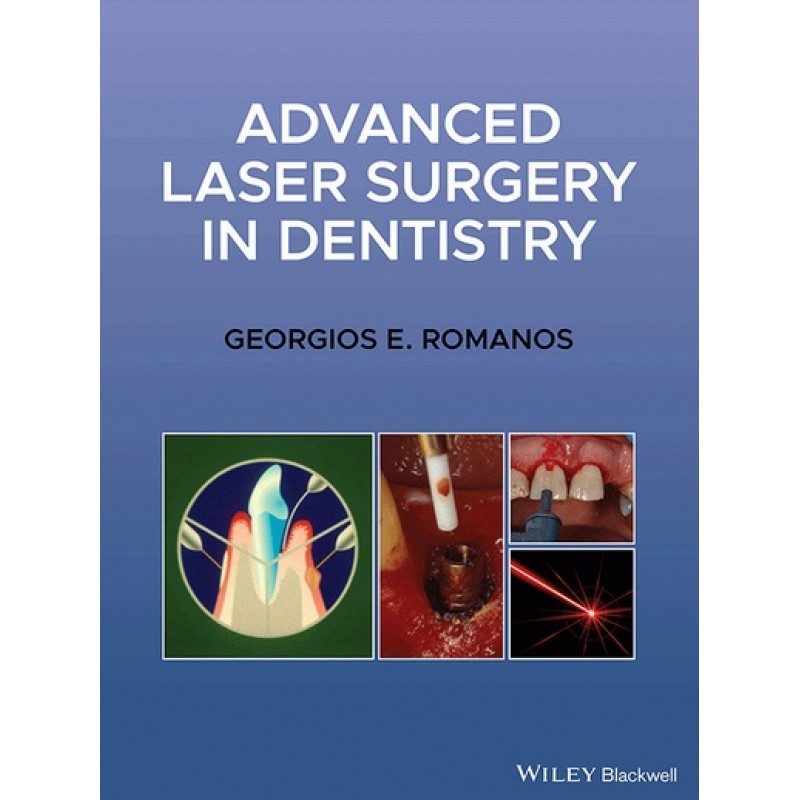 Advanced Laser Surgery in Dentistry