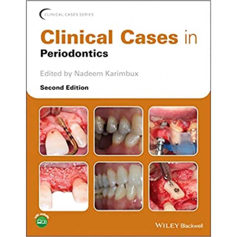 Clinical Cases in Periodontics, 2E