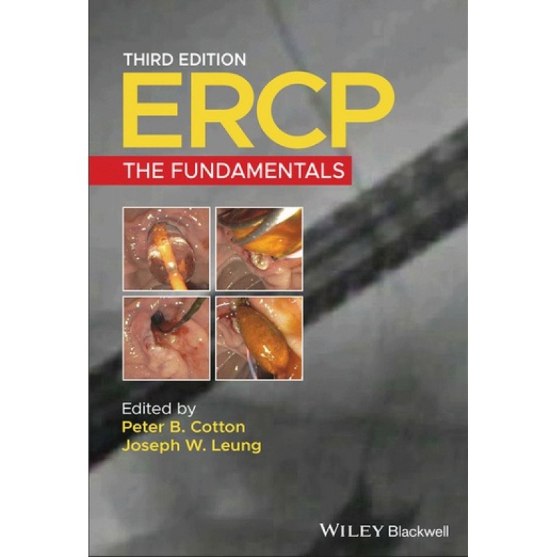 ERCP: The Fundamentals 3E