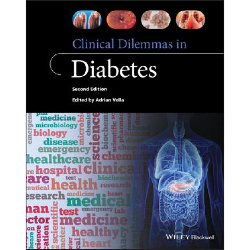 Clinical Dilemmas in Diabetes, 2E