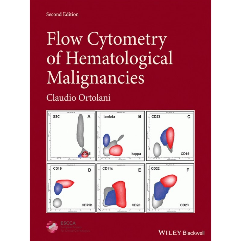 Flow Cytometry of Hematological Malignancies 2E